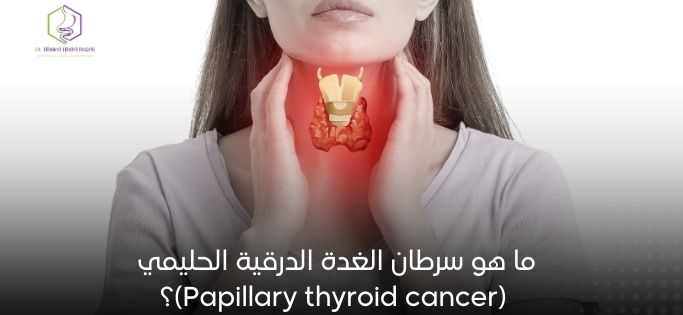 ما هو سرطان الغدة الدرقية الحليمي (Papillary thyroid cancer)؟