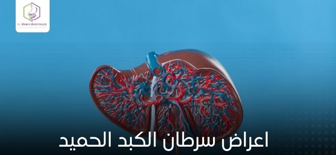 اعراض سرطان الكبد الحميد