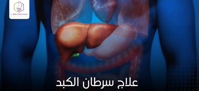 علاج سرطان الكبد
