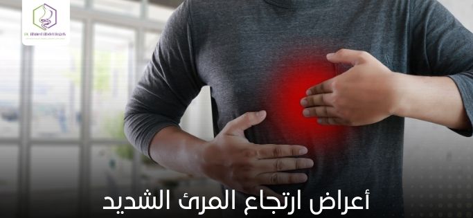 أعراض ارتجاع المرئ الشديد