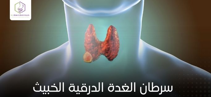 سرطان الغدة الدرقية الخبيث