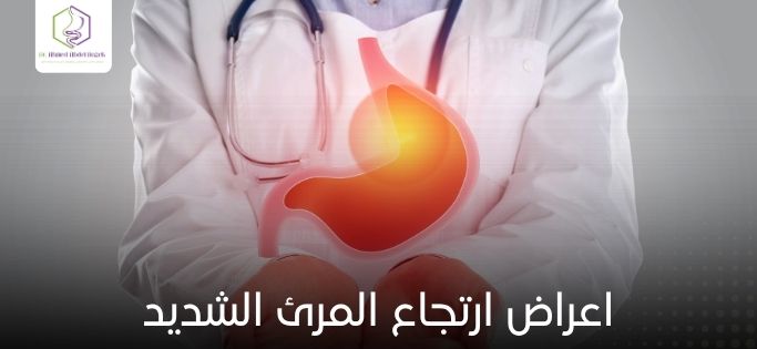 اعراض ارتجاع المرئ الشديد