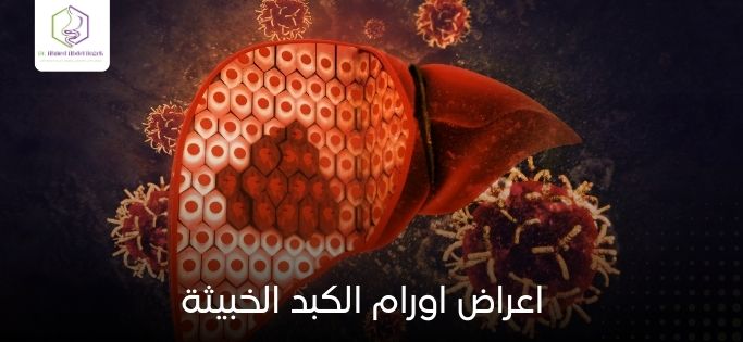اعراض اورام الكبد الخبيثة
