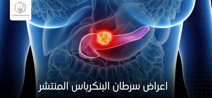 اعراض سرطان البنكرياس المنتشر