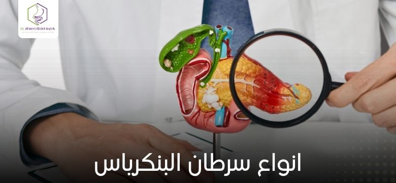 انواع سرطان البنكرياس