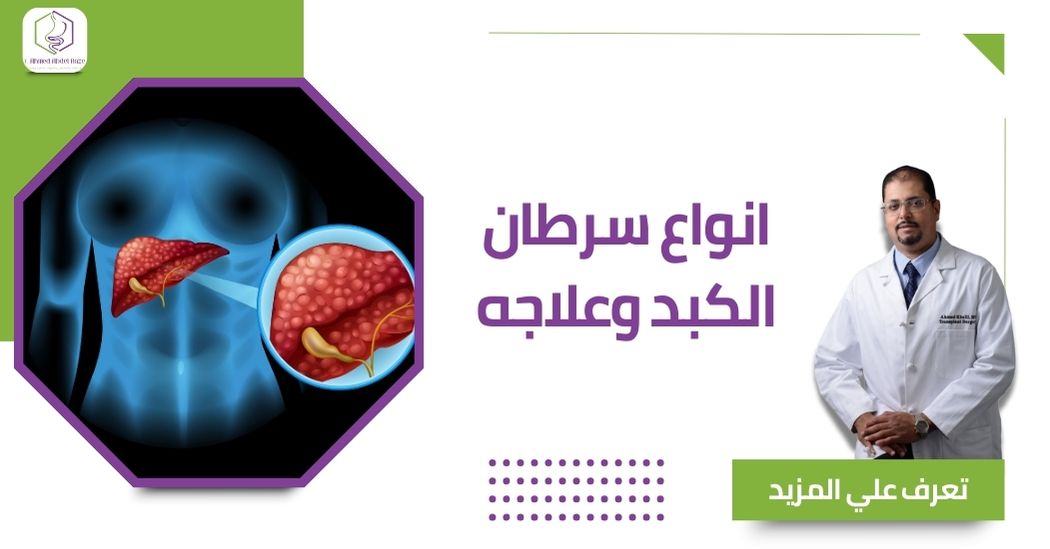 انواع سرطان الكبد وعلاجه