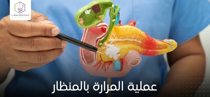 عملية المرارة بالمنظار