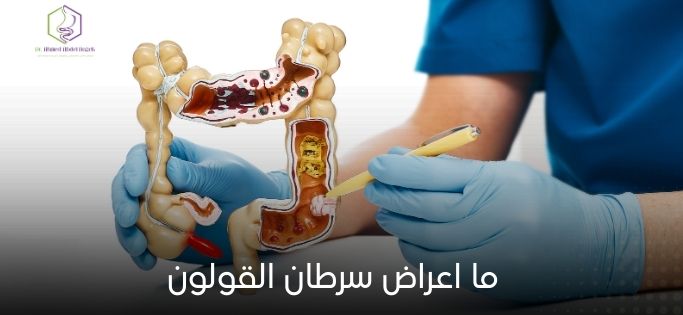 ما اعراض سرطان القولون