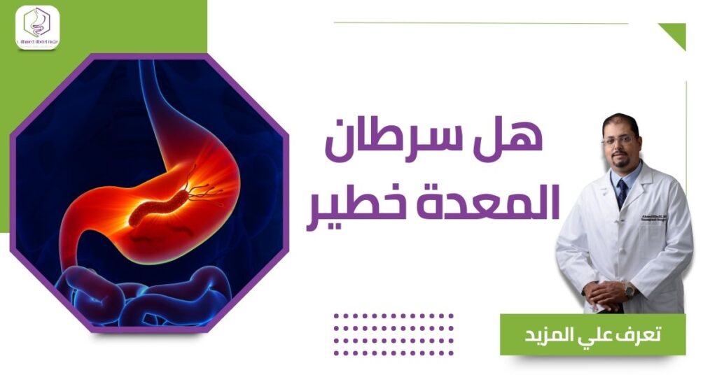 هل سرطان المعدة خطير