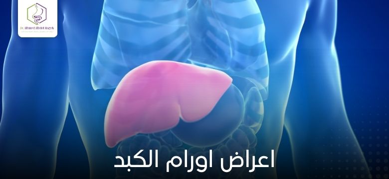 اعراض اورام الكبد