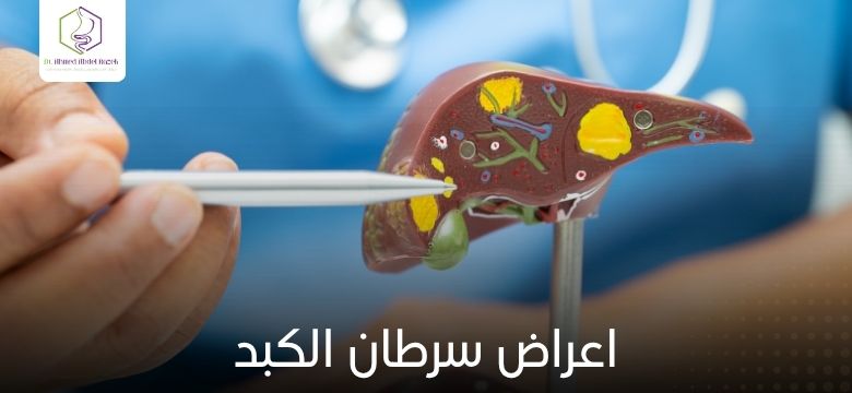 اعراض سرطان الكبد