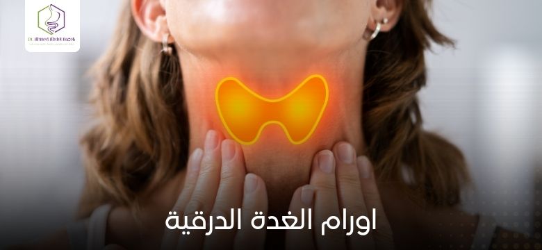 اورام الغدة الدرقية