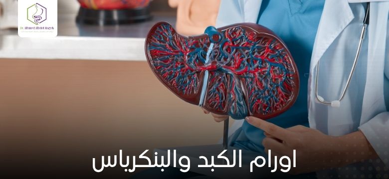 اورام الكبد والبنكرياس