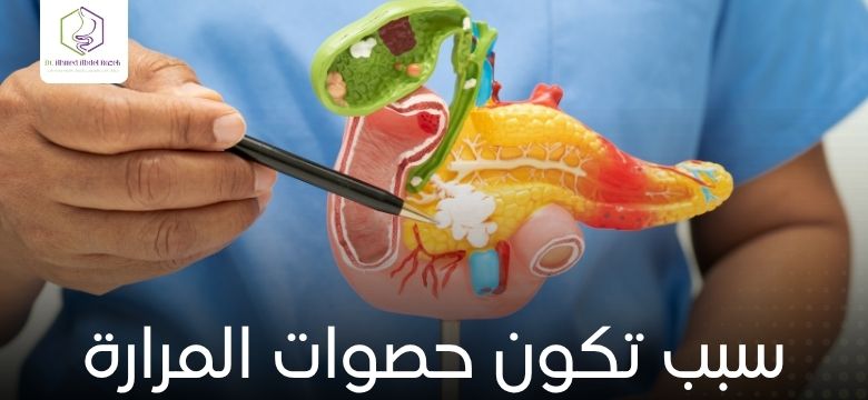 سبب تكون حصوات المرارة