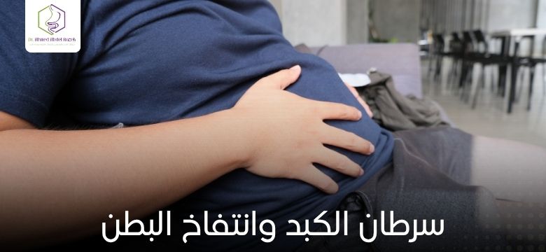 سرطان الكبد وانتفاخ البطن