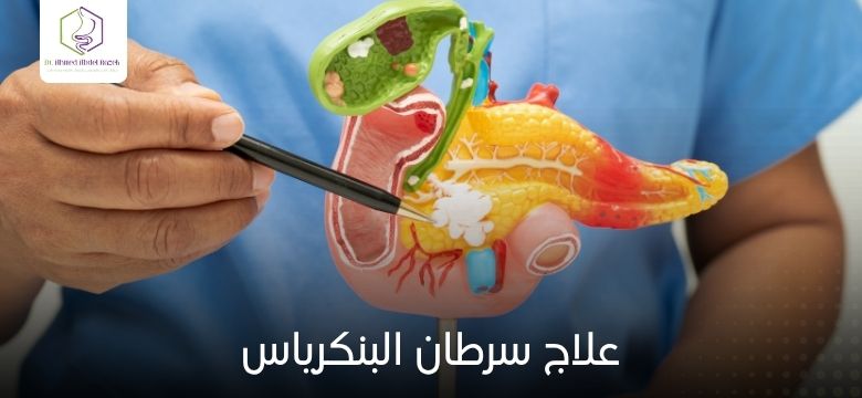 علاج سرطان البنكرياس