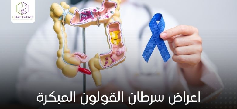 اعراض سرطان القولون المبكرة