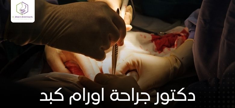 دكتور جراحة اورام كبد