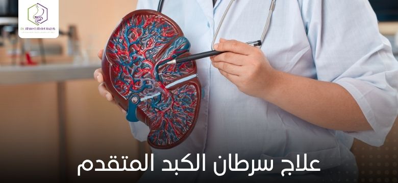 علاج سرطان الكبد المتقدم