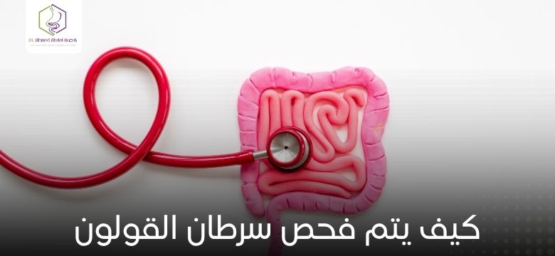 كيف يتم فحص سرطان القولون