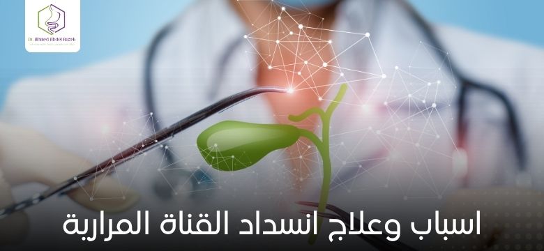 اسباب وعلاج انسداد القناة المرارية