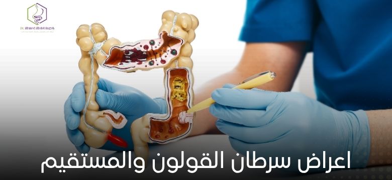 اعراض سرطان القولون والمستقيم