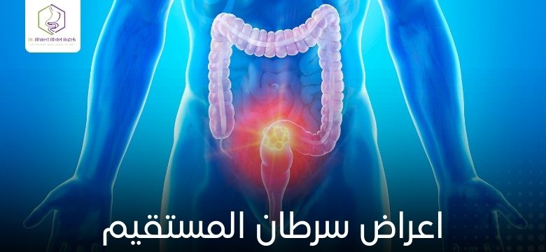 اعراض سرطان المستقيم