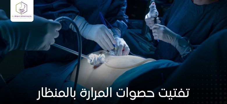 تفتيت حصوات المرارة بالمنظار