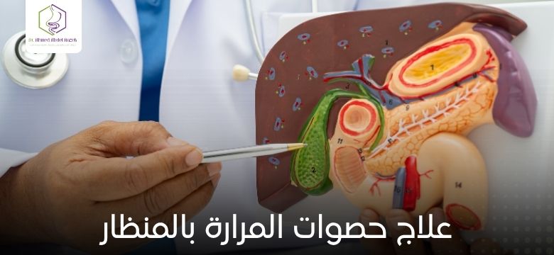 علاج حصوات المرارة بالمنظار