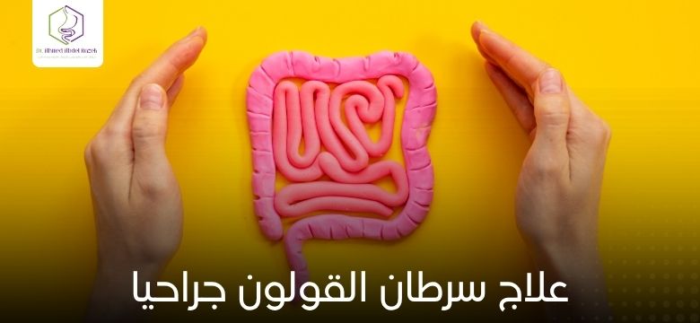 علاج سرطان القولون جراحيا