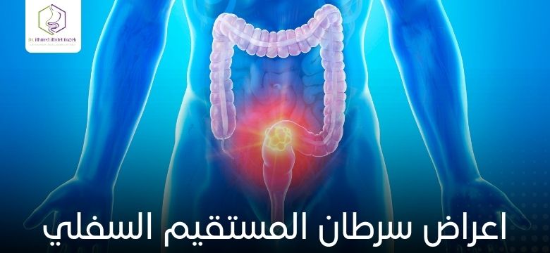 اعراض سرطان المستقيم السفلي