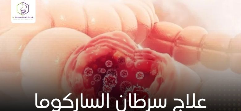 علاج سرطان الساركوما