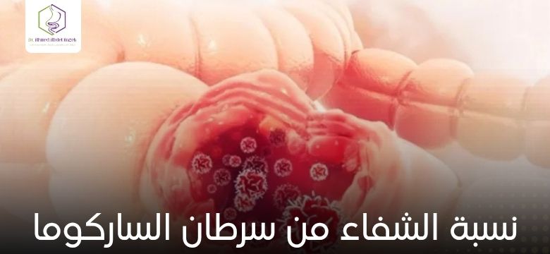 نسبة الشفاء من سرطان الساركوما