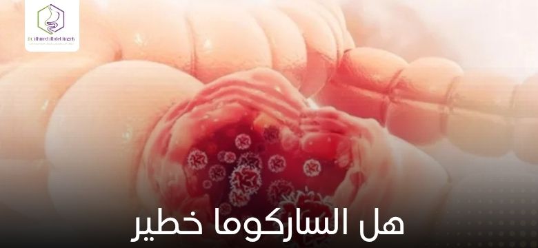 هل الساركوما خطير