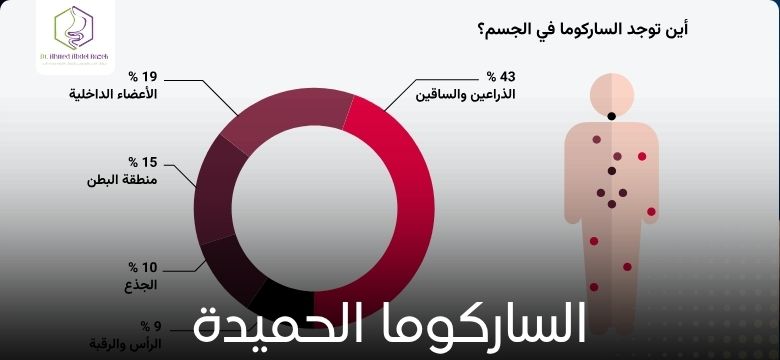 الساركوما الحميدة