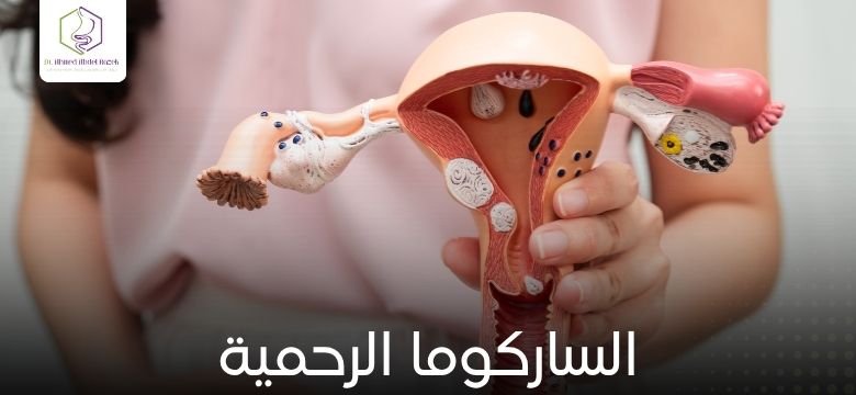 الساركوما الرحمية