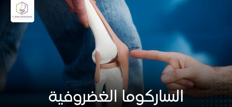 الساركوما الغضروفية