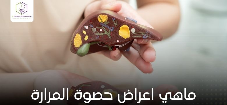 ماهي اعراض حصوة المرارة