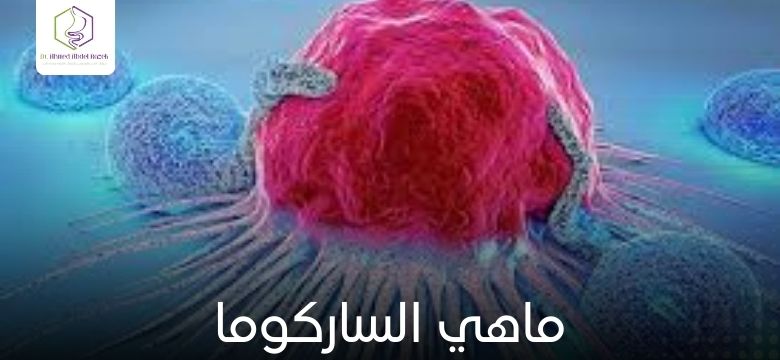 ماهي الساركوما