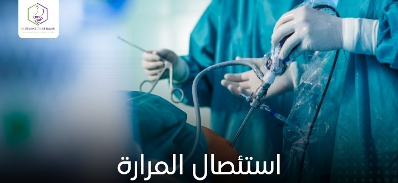 استئصال المرارة