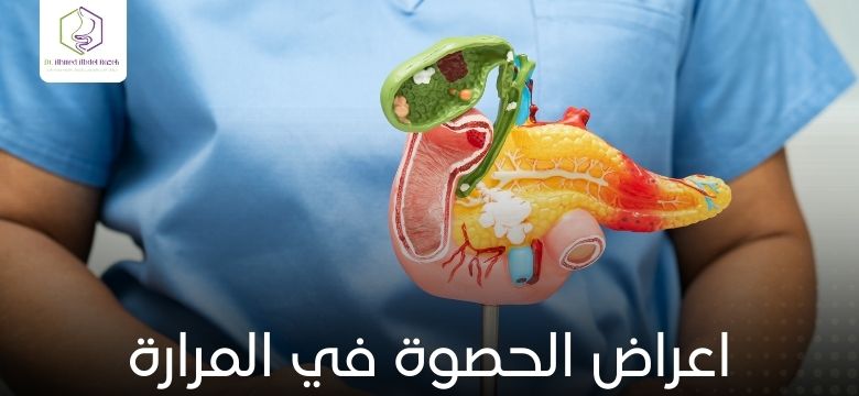 اعراض الحصوة في المرارة