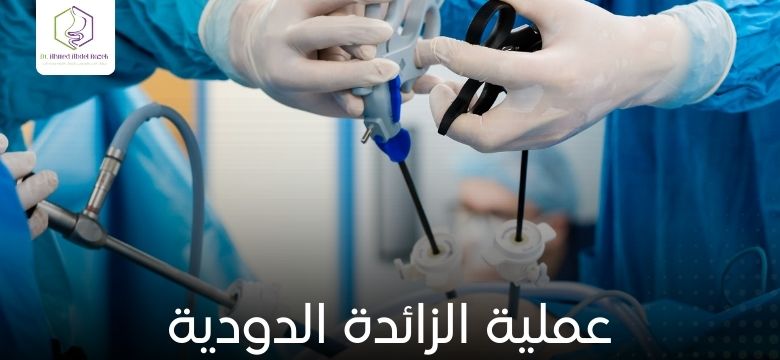 عملية الزائدة الدودية