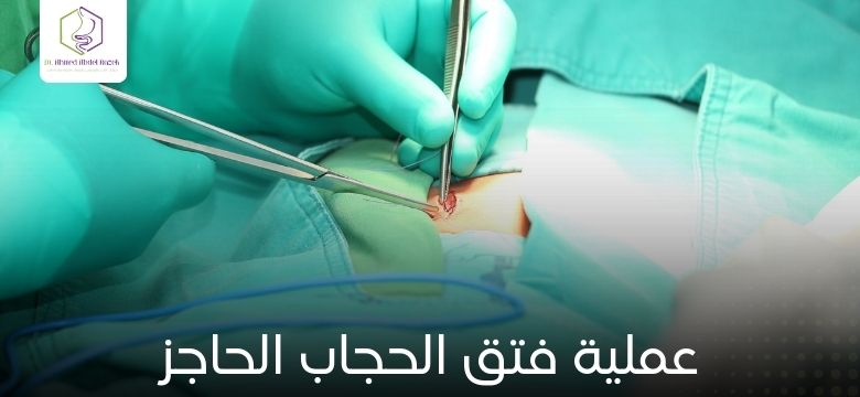 عملية فتق الحجاب الحاجز