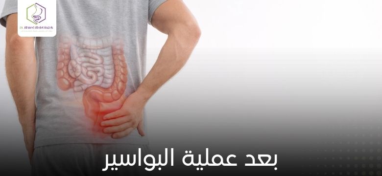 بعد عملية البواسير