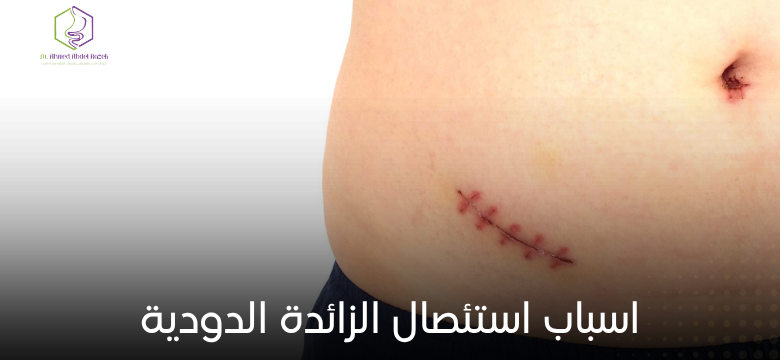 اسباب استئصال الزائدة الدودية