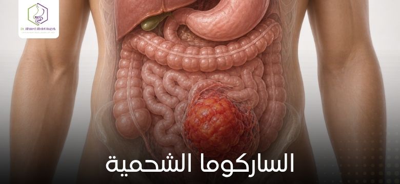 الساركوما الشحمية