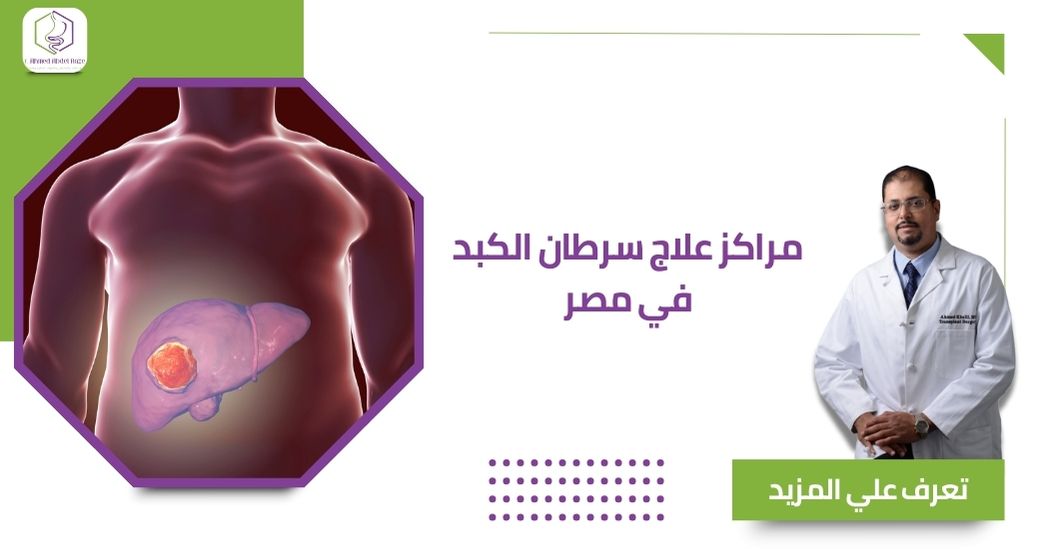 مراكز علاج سرطان الكبد في مصر