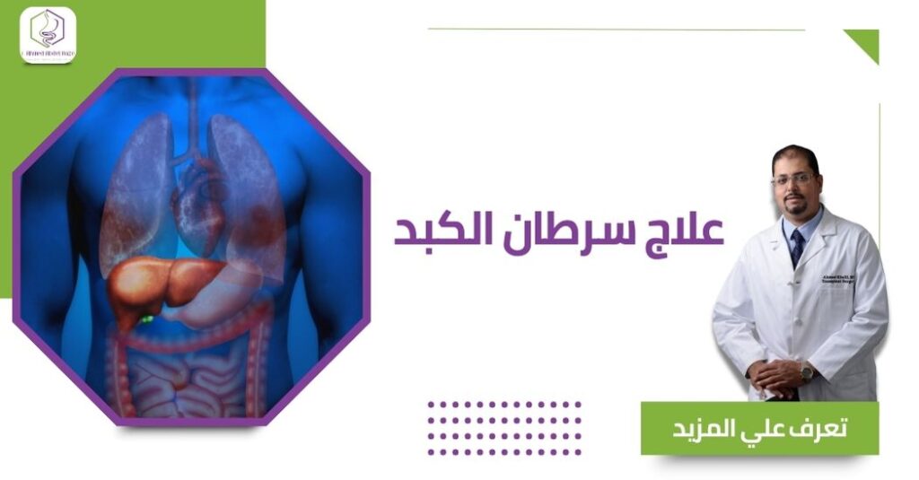 علاج سرطان الكبد