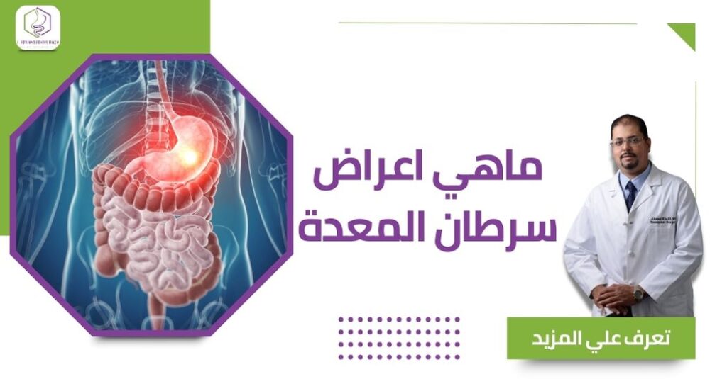 ماهي اعراض سرطان المعدة