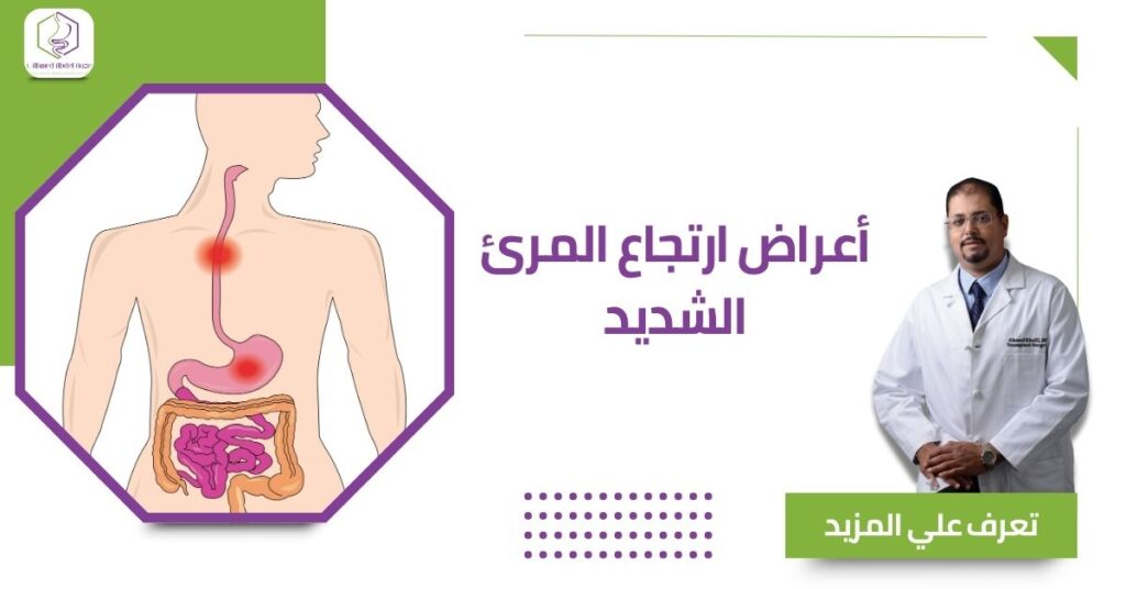 أعراض ارتجاع المرئ الشديد